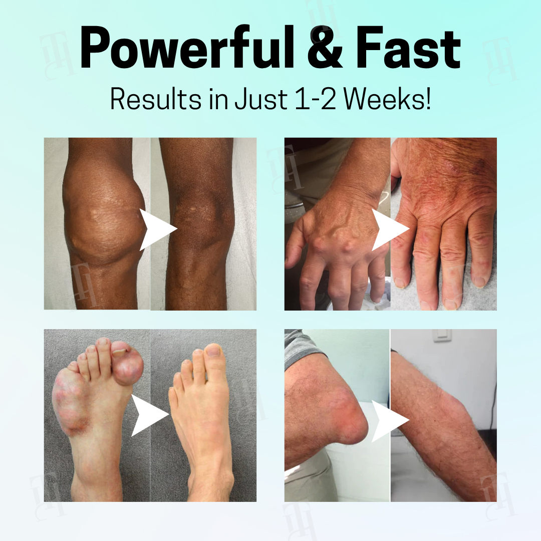 Official Store: Cvreoz® Magnesium Therapy Cream | FDA-approved. Doctor recommended.