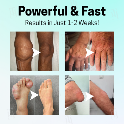 Official Store: Cvreoz® Magnesium Therapy Cream | FDA-approved. Doctor recommended.